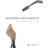 Zero Bone Loss Concepts